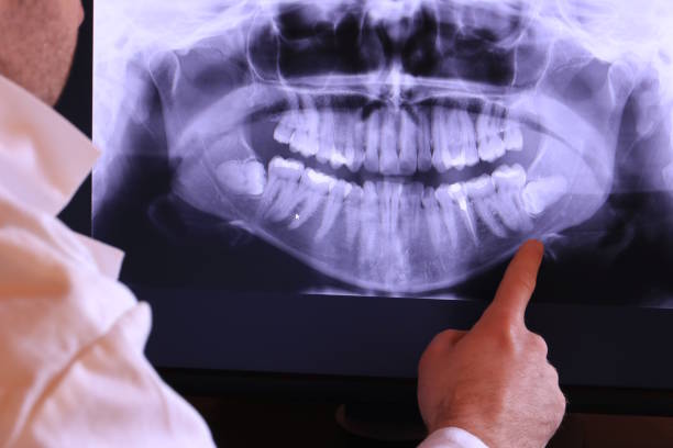 Best Chipped Tooth Repair Near Me  in Winterville, GA
