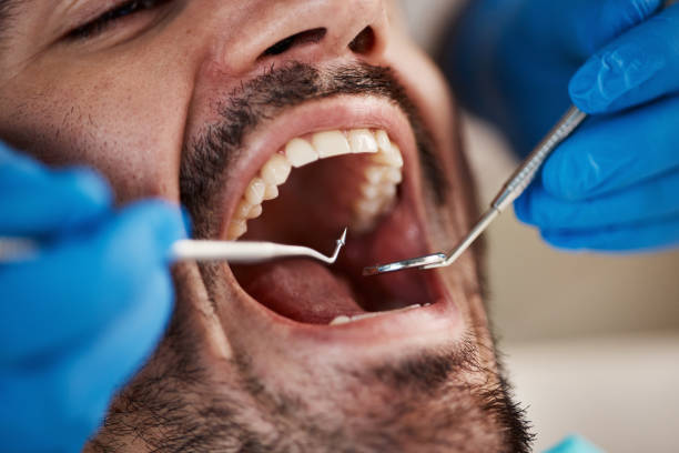 Best Urgent Tooth Repair  in Winterville, GA