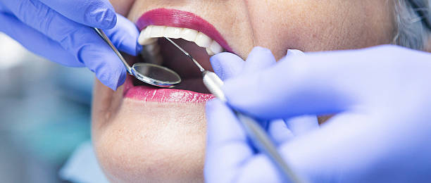 Best Root Canal Emergency Dentist  in Winterville, GA